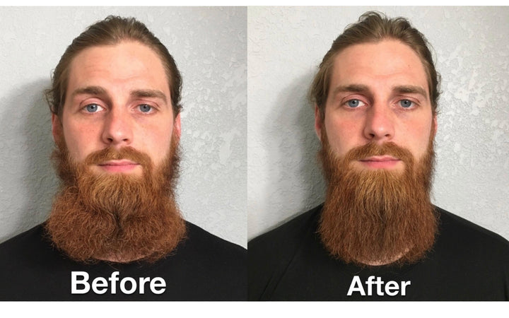 Newmen™ Premium Beard Kit